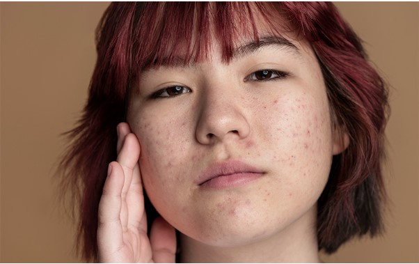 How TCM for Skin Problems in Singapore Differs from Conventional Dermatology How TCM for Skin Problems in Singapore Differs from Conventional Dermatology